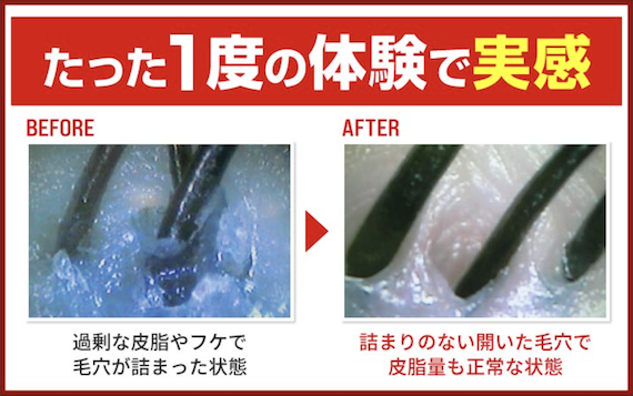 髪の毛のプロが、あなたの未来をサポート

